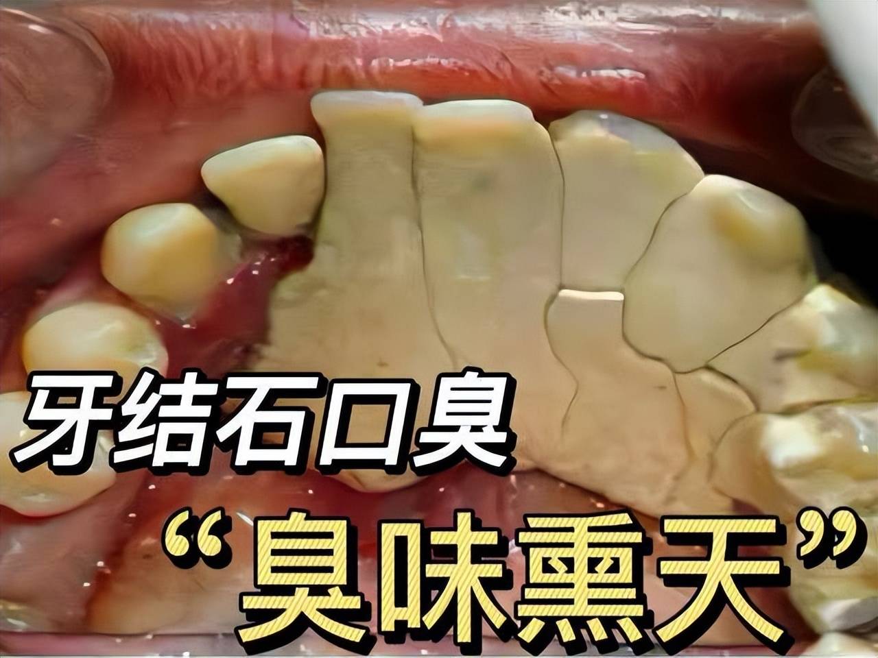 那味道_效果_薄荷味