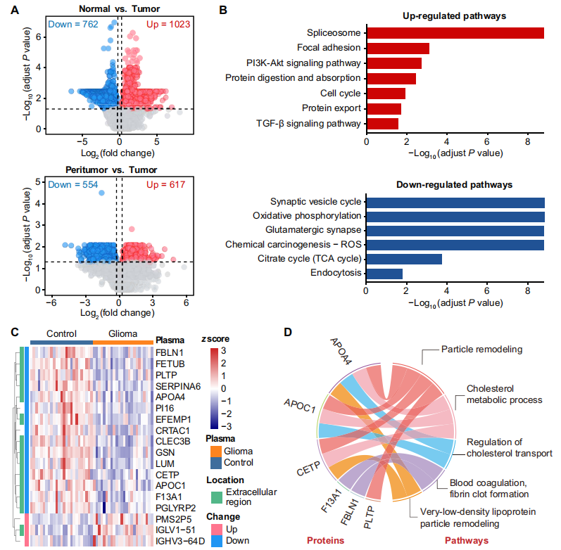 武大团队利用空间多维蛋白组学揭示胶质瘤新成果_蛋白质_神经_患者