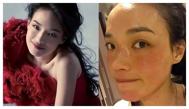 舒淇晒惊人粗壮手臂照!搞笑自曝奇怪病情,网友围观热议.