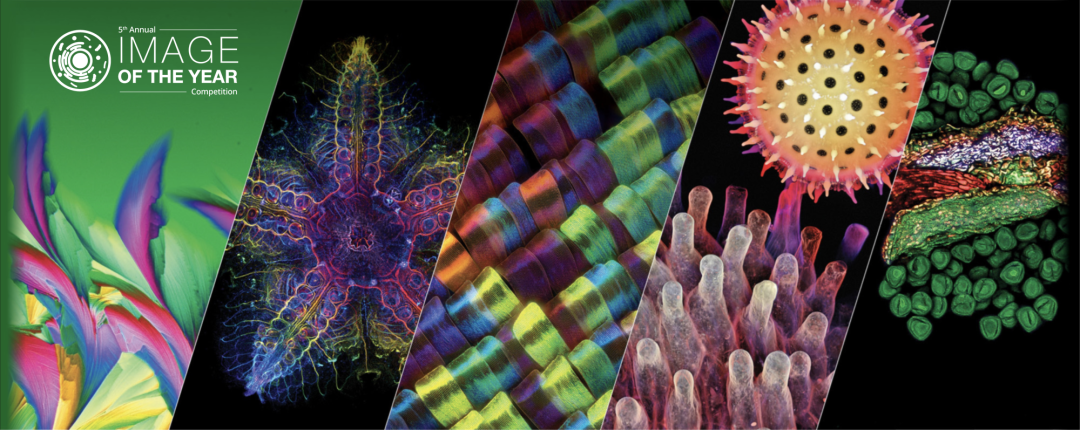 evident第五届全球显微图像大赛瞩目盛启!_显微镜_获奖者_视频