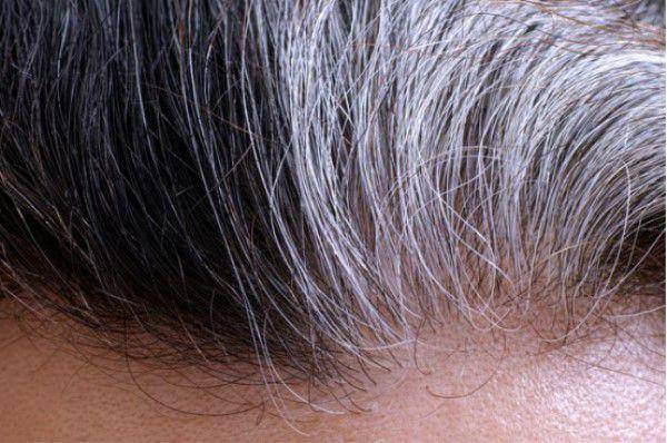 原创白发长在哪病就在哪出长在前额两鬓后脑勺分别说明什么