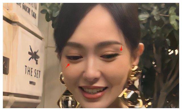 面部状态遭到质疑,不少网友认为刘诗诗的面部看起来不太协调,苹果肌过