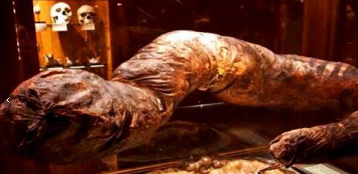 原创3年没上过一次厕所被排泄物活活憋死36斤粪便被无数人参观
