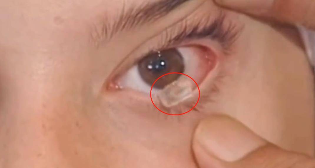 水晶每当她翻一下眼皮都会掉下来一块,翻一下眼皮就掉下来一块.