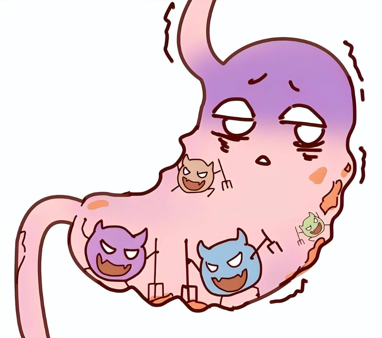 患上胃溃疡到底该怎么吃?"溃疡饮食"助你打好保"胃"战_食物_胃酸_蔬菜