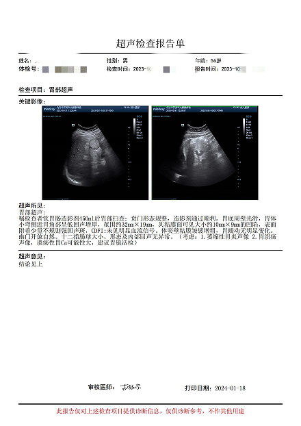 未去医院检查,再次告知他目前胃部超声完全符合溃疡性胃癌的诊断标准