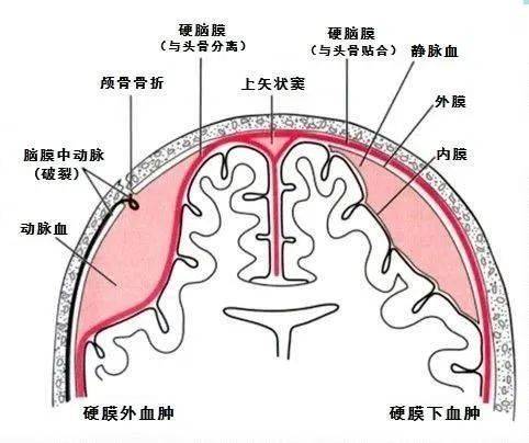 头颅硬膜图片