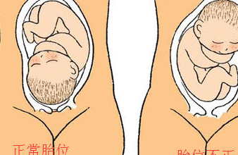 原创科普这一坏习惯极容易导致胎位不正孕妈们还再这样做吗