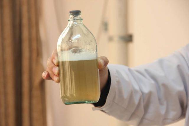 原创尿毒症是怎么来的医生提醒如有2处发臭晚上尽量坚持3不要