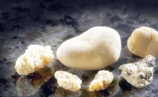 原创肾结石真的可以自己排出来吗你或许真的不知道看专家的理解