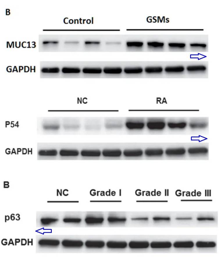 多处图片重复山东大学齐鲁医院的论文引热议