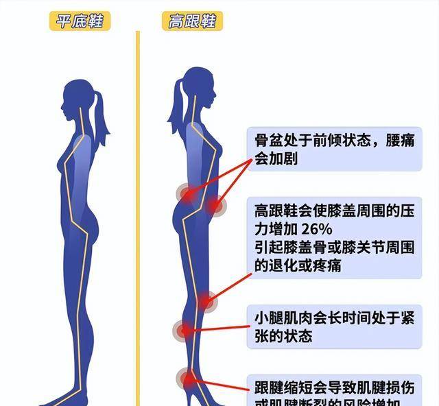原创等你老了一定要杜绝鞋带跟裙不过膝这样穿才美得优雅得体