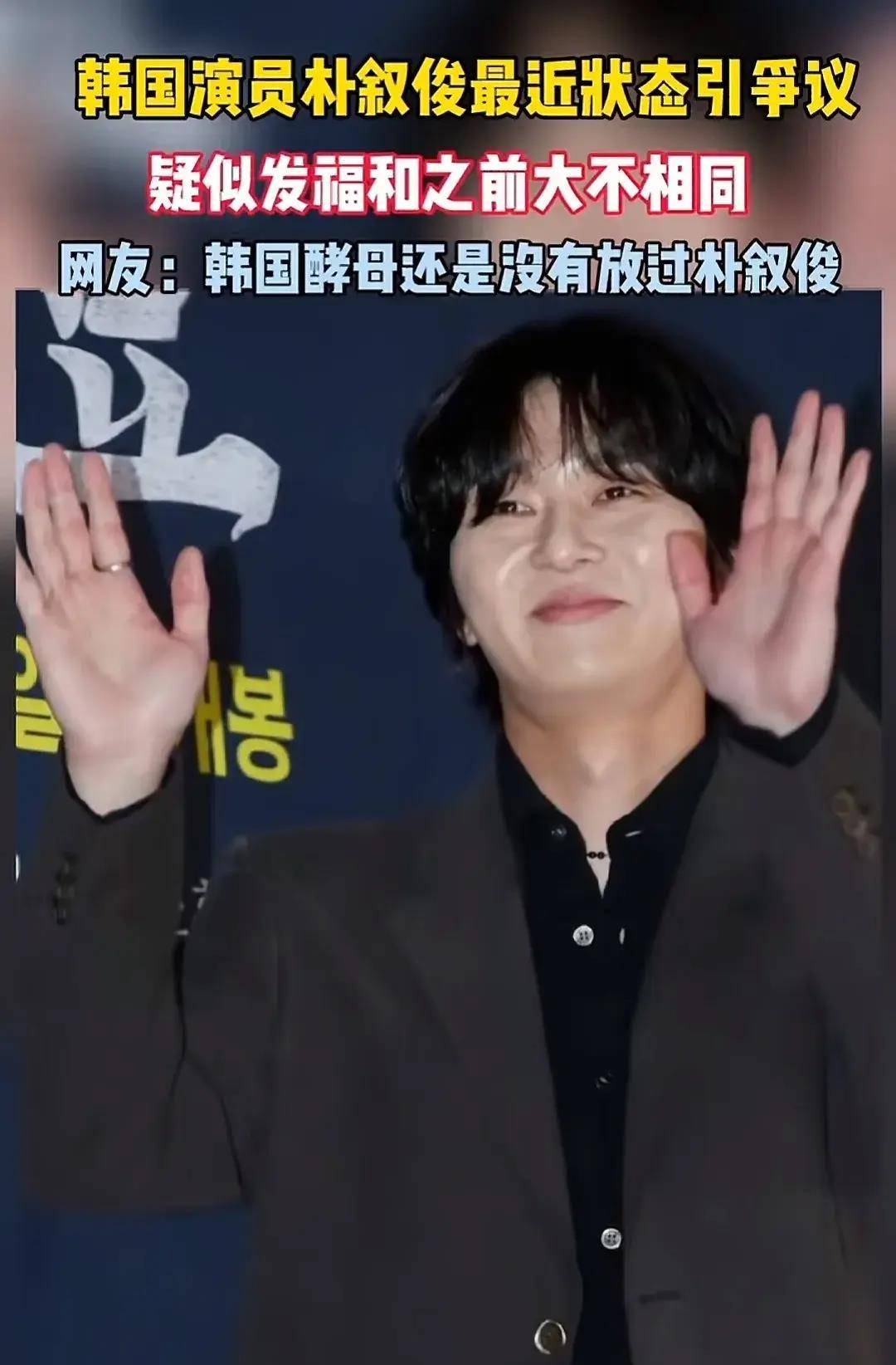 原创恋爱后李钟硕终于还是肿了酵母风对韩国男艺人一视同仁