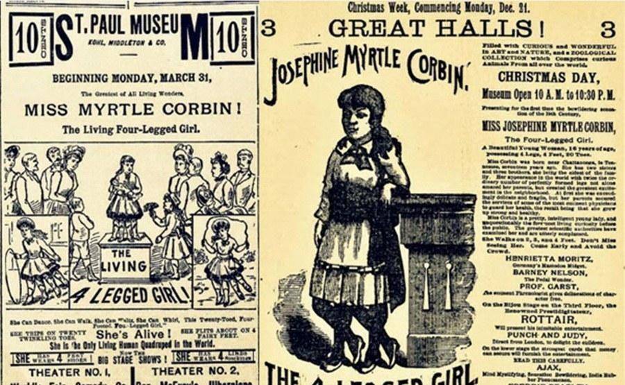 后来,一个专门利用畸形秀牟利的商人巴纳姆(p.t.