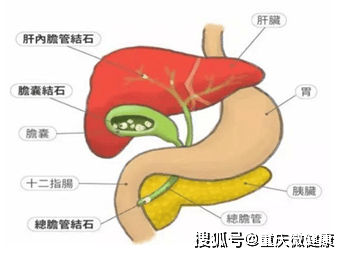 可能命悬胰腺