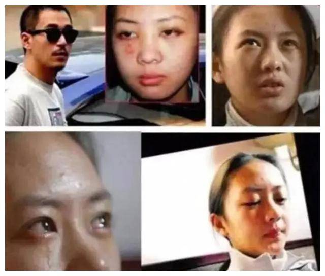 2003年,18岁"小章子怡"童瑶被张国立儿子暴打,这气她憋多久?