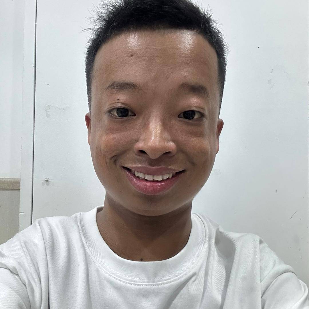 原创网红咖啡豆患骨癌需截肢光头仍笑容满面小杨哥全程赞助背后故事引