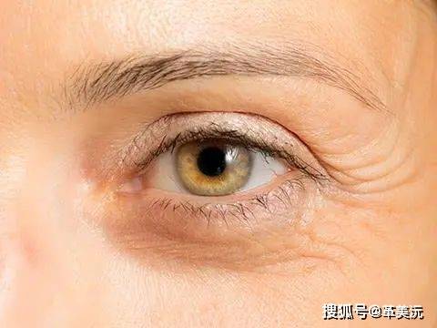 4种"催老剂",尽快远离!_皮肤_皱纹_压力