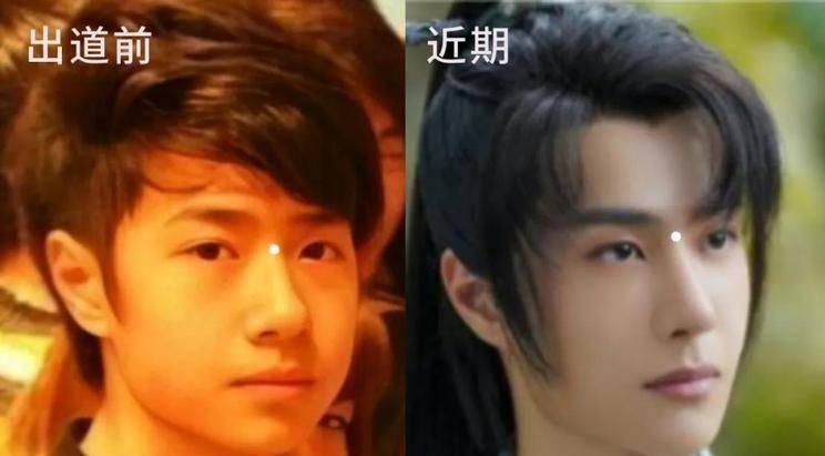 面对浩浩荡荡的整容传闻,王一博的粉丝却并不买账,高举着"原装脸"的