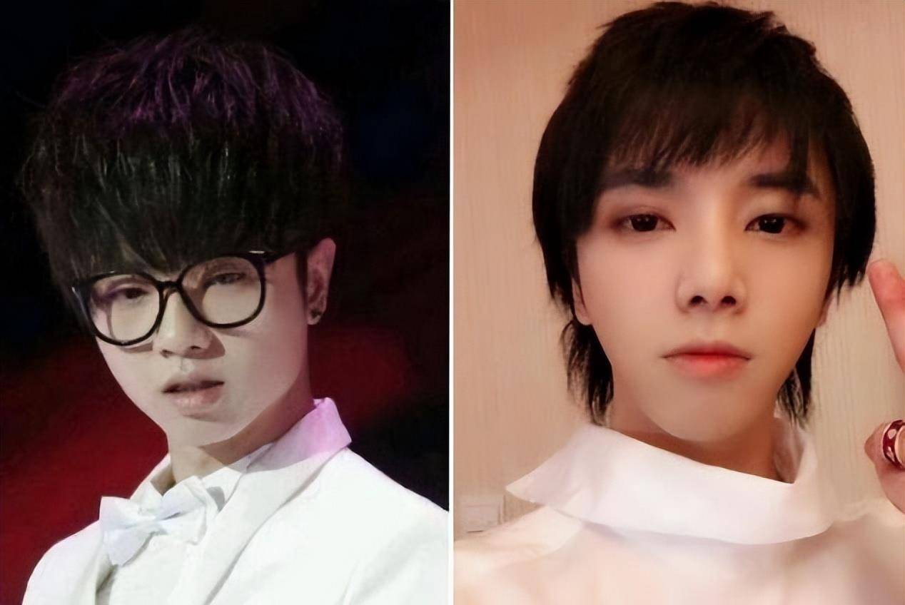 8位"改头换命"的男明星,王一博脸已僵硬,刘恺威眼皮才是灵魂_华晨宇