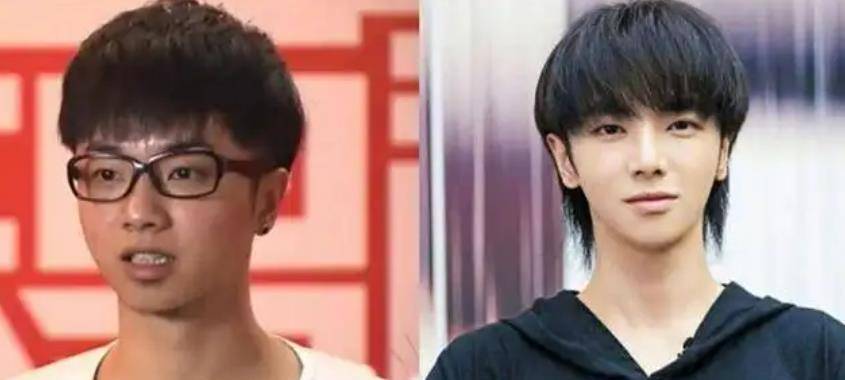 8位"改头换命"的男明星,王一博脸已僵硬,刘恺威眼皮才是灵魂_华晨宇