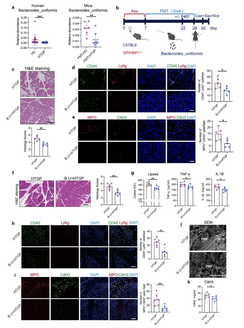哈尔滨医科大学发现肠道菌群调控高甘油三酯性胰腺炎进展的新机制