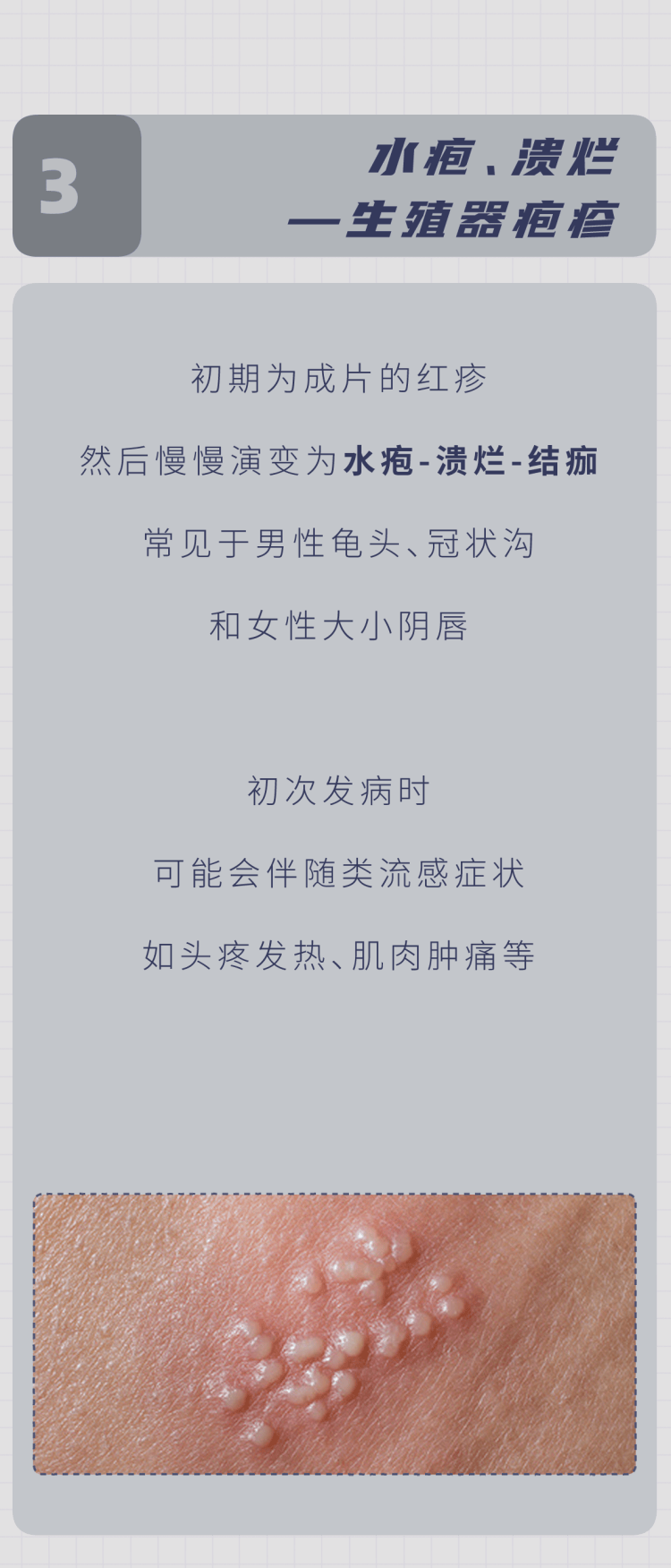 原创怎么在性生活前判断伴侣有没有性病5个检查男女都该清楚