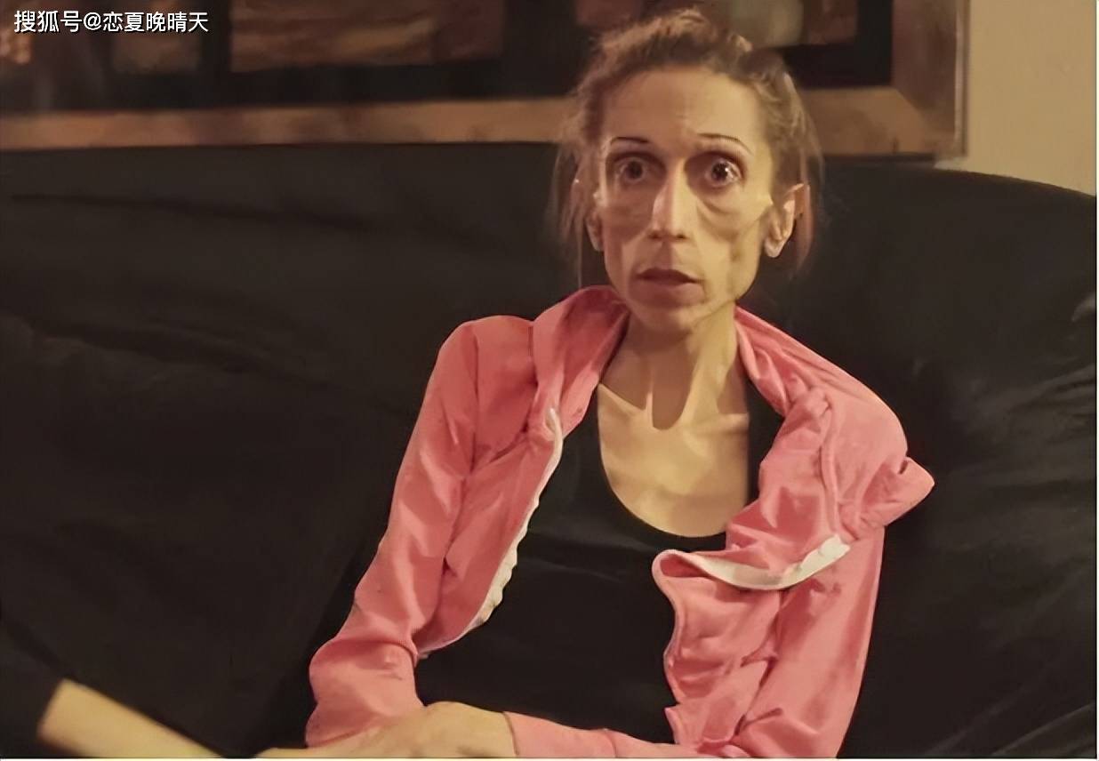 女子节食暴瘦44斤想"饿死"肿瘤