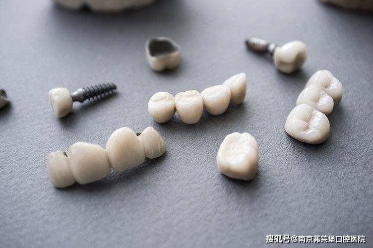 南京无痛全口半口种植牙医院牙垢用什么东西可以去除