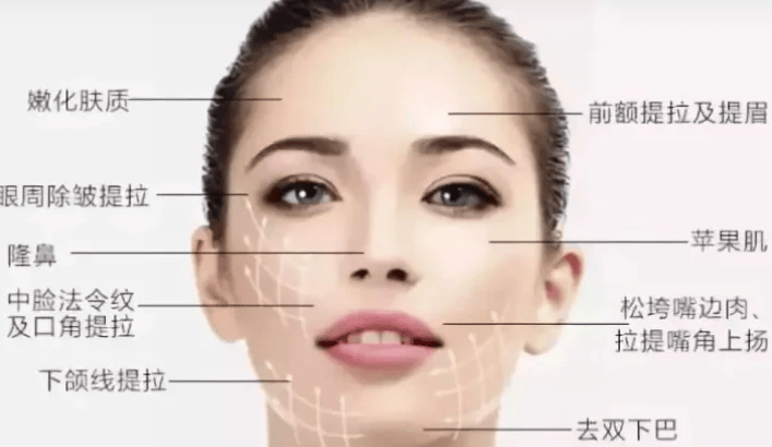 没有最好只有更好目前来说最好的线雕是哪种哪些人不适合做线雕