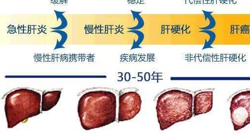 这种野草能治肝炎肝硬化腹水吃完就可能痊愈你家门口就有