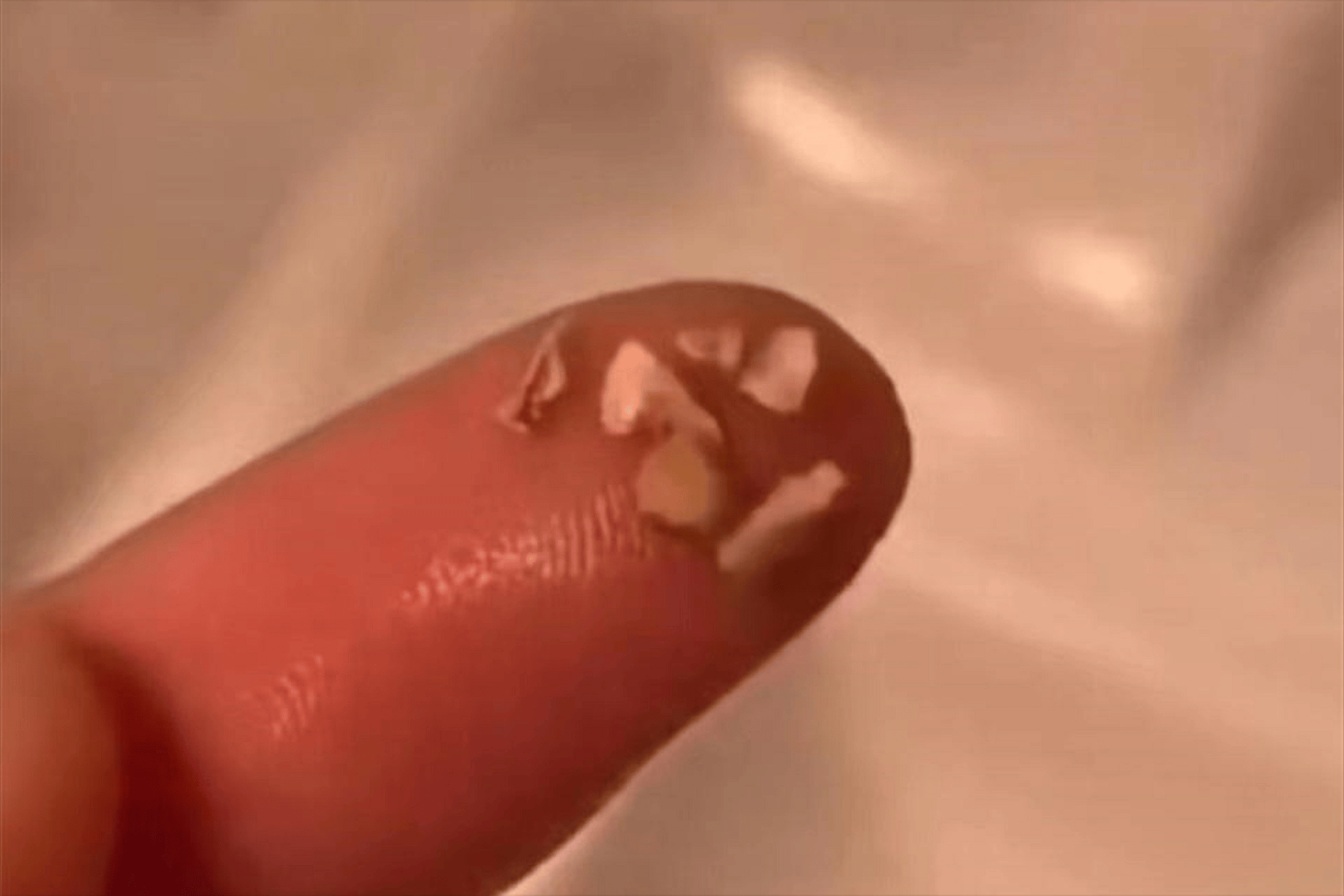 牙结石手扣会致命!过来人自用方法分享,30天轻松拥有健康亮白齿