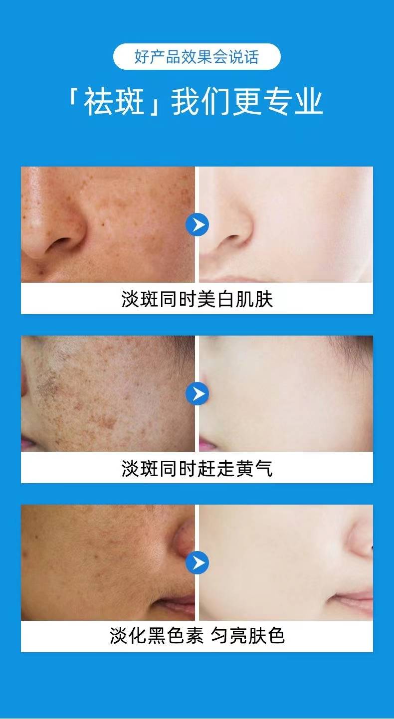 美妆达人推荐榜单美白淡斑护肤品推荐来啦