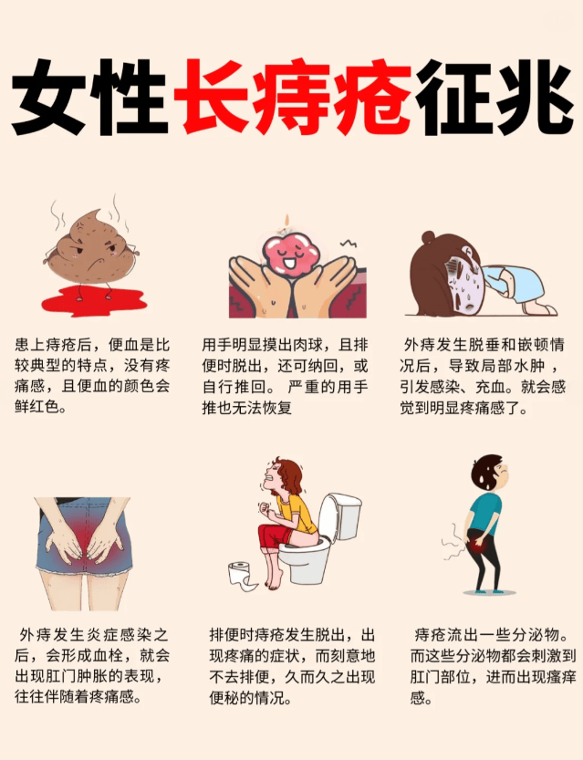 女性痔疮 轻度图片