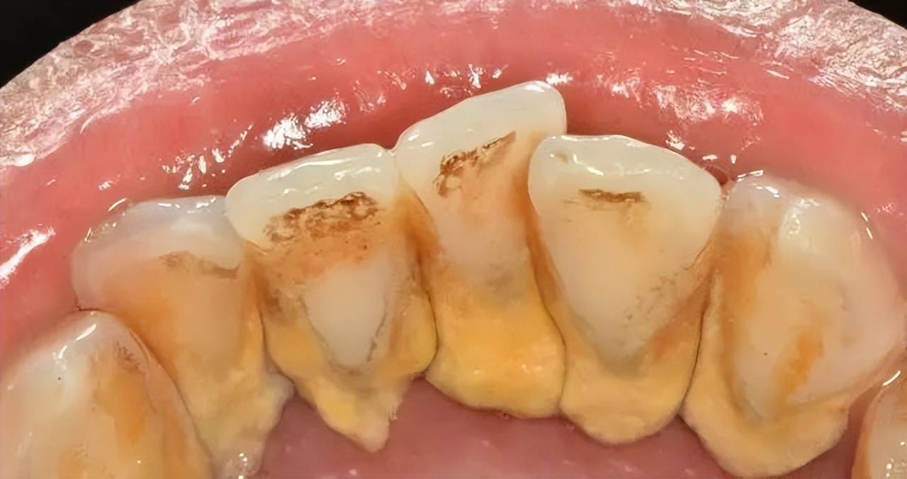 口腔_牙齿_牙粉