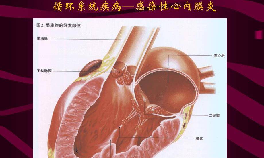 原创真实故事32岁小伙拉肚子导致心脏骤停医生拼尽全力也无力回天