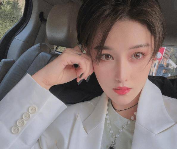 原创张馨予晒受伤照片腿上淤青额头扎针穿迷彩t恤出镜引热议