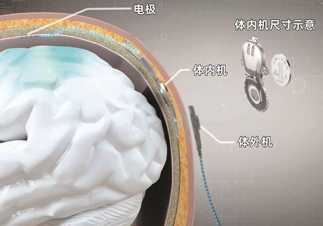 中国脑控活体实验图片