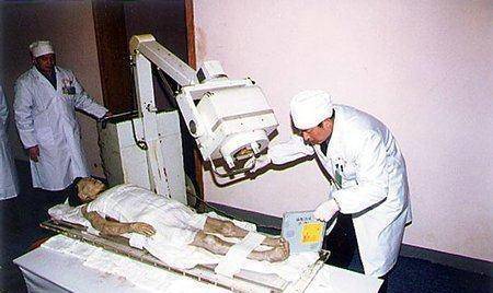 分别古埃及的木乃伊和马王堆女尸为代表,但本人认为中国的马王堆女尸