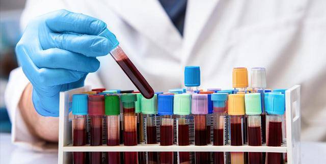 原创为什么一到医院就要抽血医生揭秘抽出来的血最终去了哪里