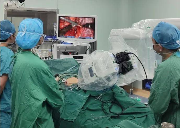 完成国内首例单孔机器人辅助经肋间入路右后纵隔肿瘤切除术,切下一个