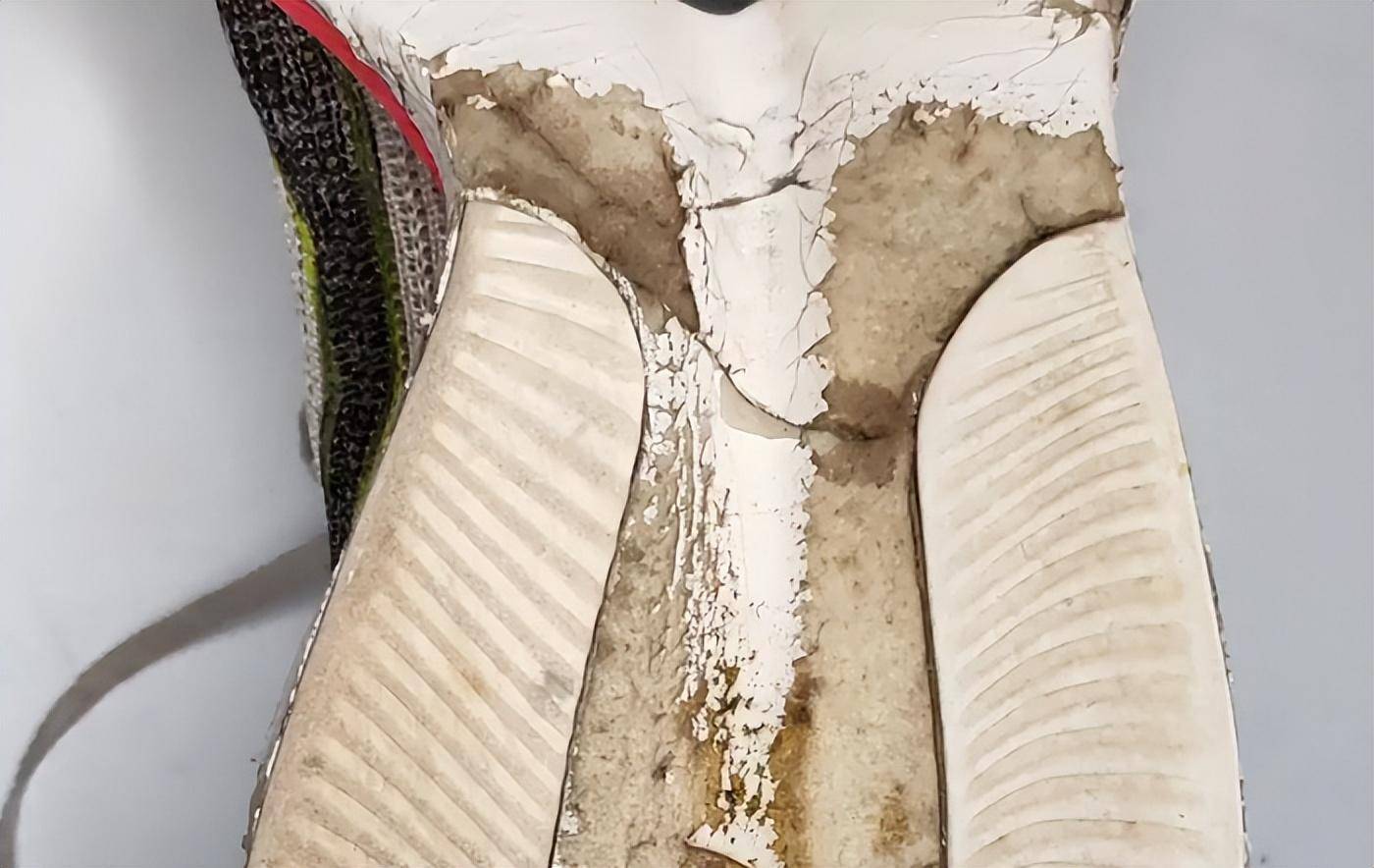 鞋底如果是这3种情况,需多留意!_磨损_足部_炎症