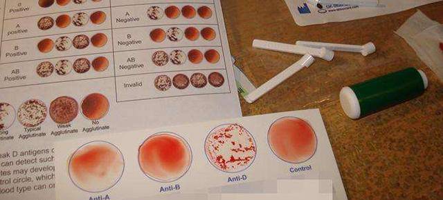 70亿分之一比中彩还难千倍唯一血型出现在中国江苏全球仅一例