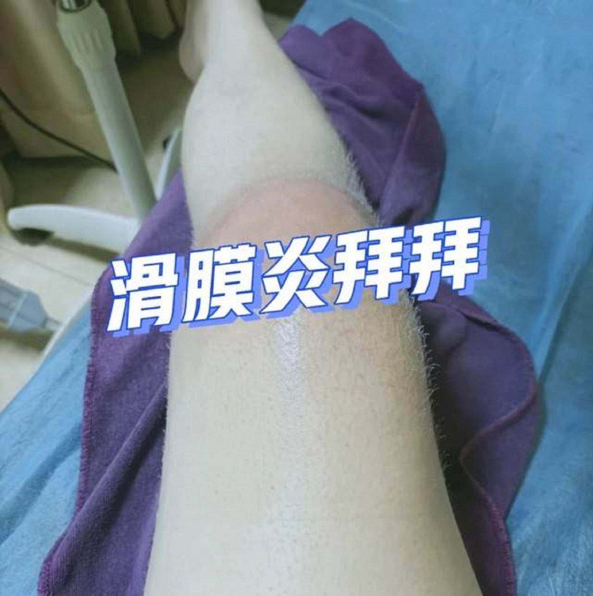 膝盖_效果_小时