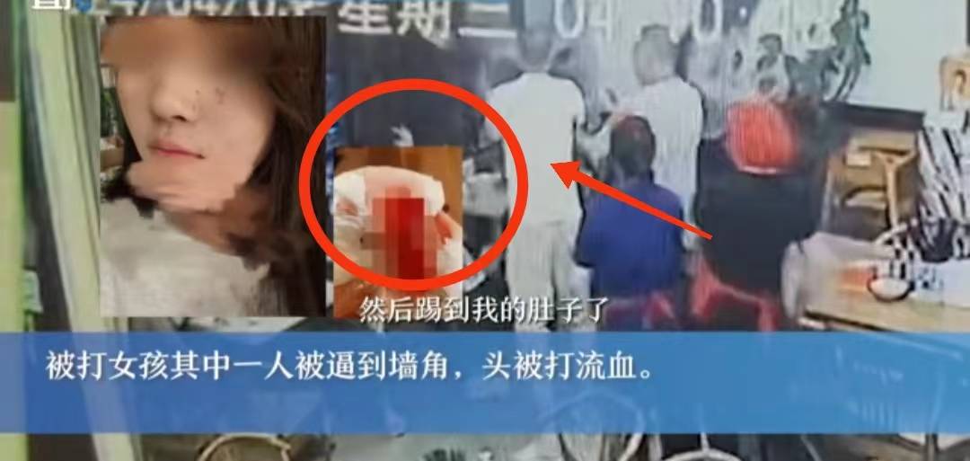 原创女孩拒绝陪酒被打打人者欲拿200元私了女孩晒受伤照怕判互殴