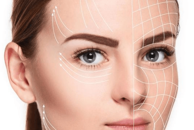 做线雕提升脸部好不好浅浅感受下线雕脸1到7天恢复过程图片