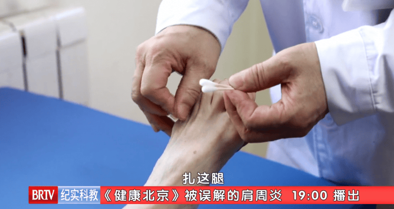 东城中医医院特聘专家王凡做客健康北京被误解的肩周炎