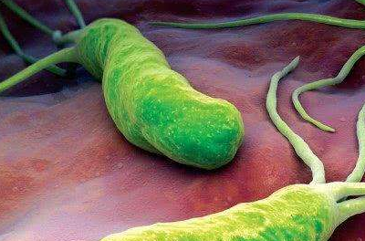 原创别嫌它丑却是幽门螺杆菌的天敌每天吃两粒胃病不来扰