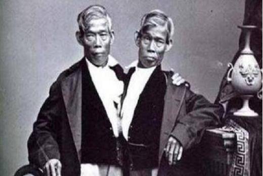 原创华人连体兄弟赴美表演暴富后娶姐妹花生22个孩子