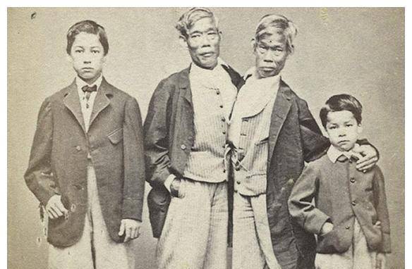 原创连体人怎样结婚生子泰国连体兄弟娶了一对姐妹生育了22个孩子